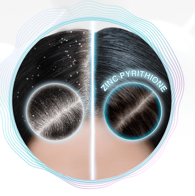 Giảm gàu ngứa từ thành phần trái bơ và Vitamin E giữ ẩm Giảm gàu ngứa từ thành phần trái bơ và Vitamin E giữ ẩm