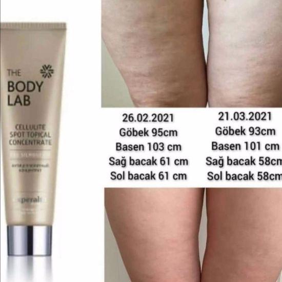 Kem giảm mỡ Experalta Platinum The Body Lab còn giúp giảm tình trạng sần vỏ cam dưới da đùi, cánh tay Kem giảm mỡ Experalta Platinum The Body Lab còn giúp giảm tình trạng sần vỏ cam dưới da đùi, cánh tay