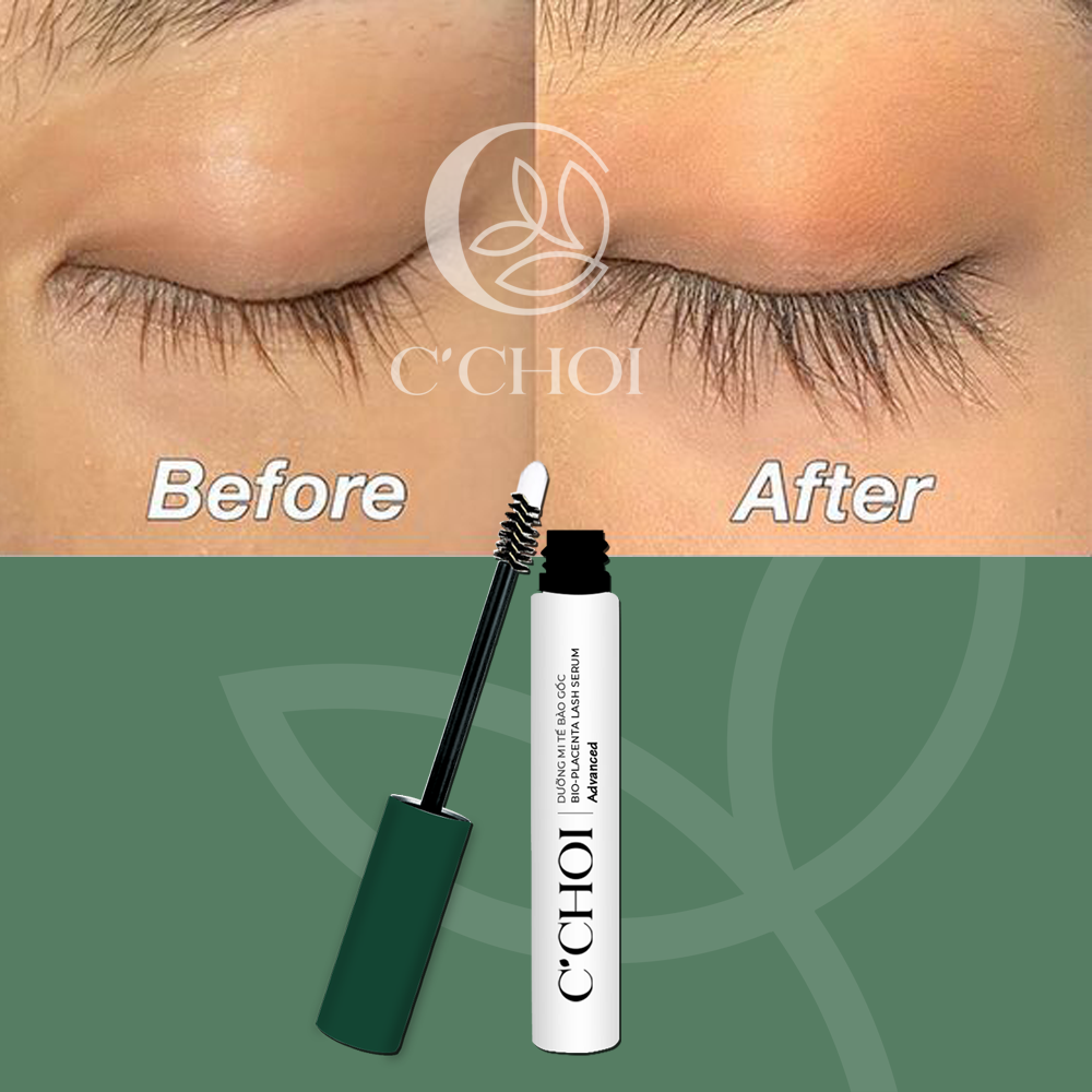 Phản hồi của khách hàng dùng Dưỡng mi tế bào gốc C'Choi Phản hồi của khách hàng dùng Dưỡng mi tế bào gốc C'Choi