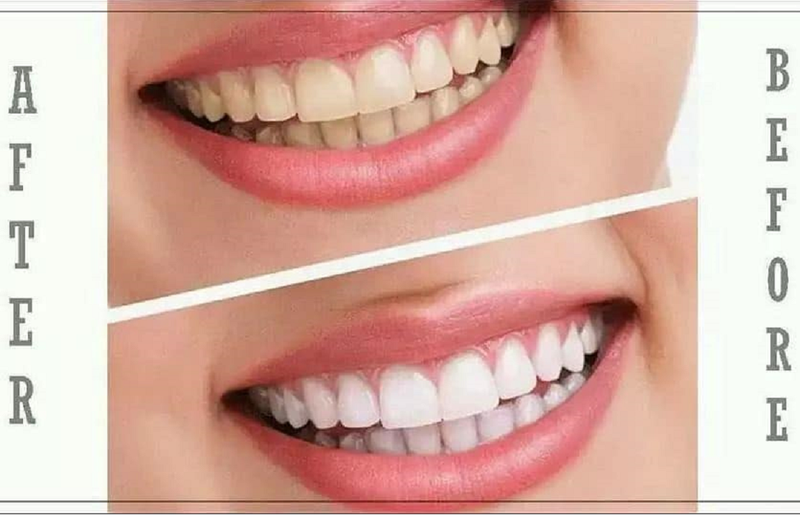 Kem đánh răng AP24 cho bạn hàm răng trắng khỏe sau 3-4 tuần sử dụng Kem đánh răng AP24 cho bạn hàm răng trắng khỏe sau 3-4 tuần sử dụng