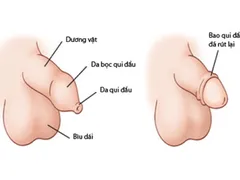 Dương vật nam giới như thế nào là đẹp? Kích thước dương vật như nào mới đạt chuẩn? Mr1985