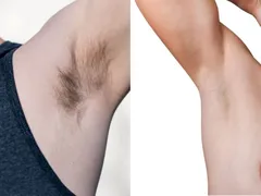 Nam giới có nên cạo lông nách?