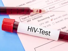 7 cách quan hệ tình dục không bị lây nhiễm HIV, bạn nên biết - Mr1985