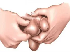 Thuốc bôi có làm tăng kích thước dương vật? Mr1985