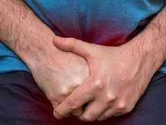 Hoại tử dương vật nếu bạn không biết điều này