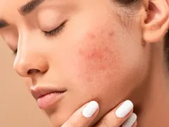 Đắp mặt nạ tinh trùng để trẻ hóa da: Hiệu quả hay nguy hiểm? Mr1985