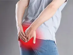 Rách Hậu Môn Khi Quan Hệ: Nguyên Nhân, Cách Xử Lý Và Phòng Ngừa - Mr1985