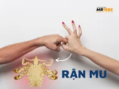 Quan hệ tình dục có mắc rận mu không?