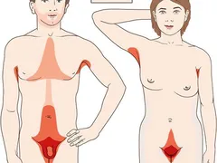 Rận Mu Ở Nam Giới và Nữ Giới: Có Gì Khác Biệt? - Mr1985
