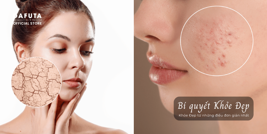 Hậu quả của việc đắp mặt nạ không đúng thời gian