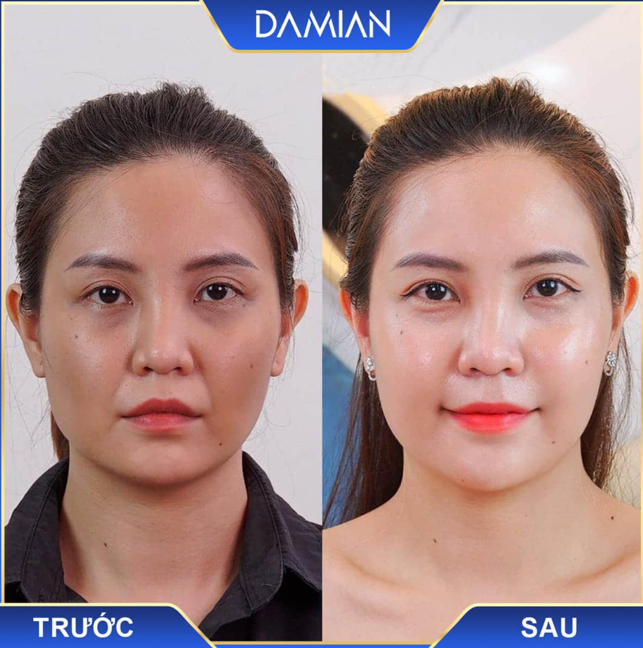 Khách dùng viên uống trắng da damian Khách dùng viên uống trắng da damian