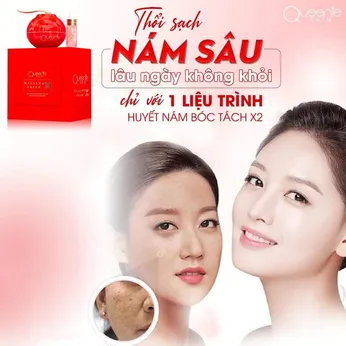 Kem Face Nám X2 Queenie