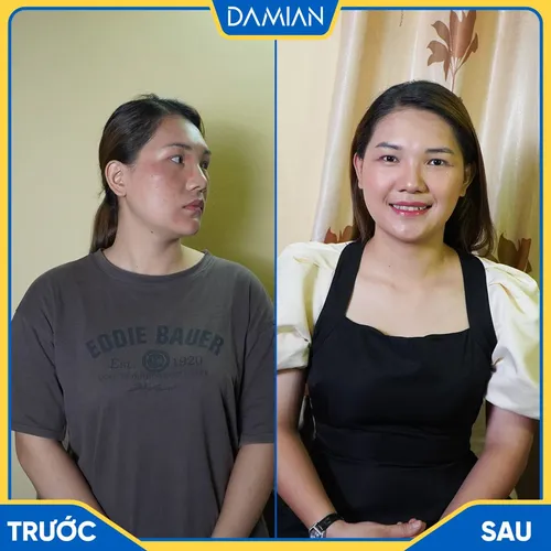 Viên Uống Trắng Da Damian Chính Hãng