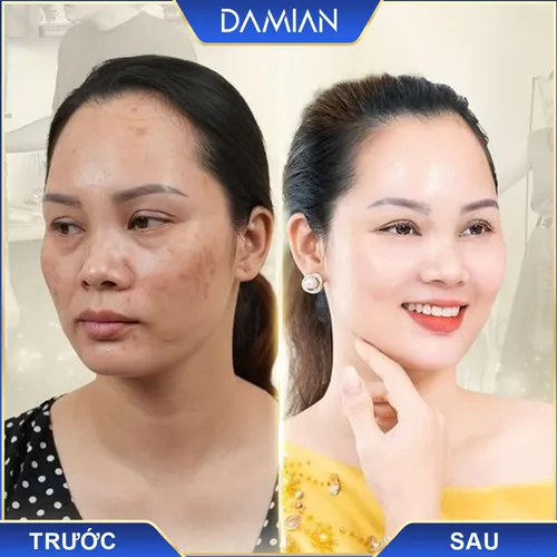 Viên Uống Trắng Da Damian Chính Hãng
