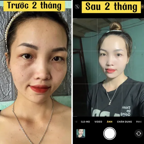 Kem Face Meea Collagen Cá Hồi V2