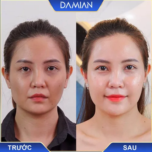 Viên Uống Trắng Da Damian Chính Hãng