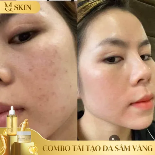 Combo Tái Tạo Da Sâm Vàng Mq skin
