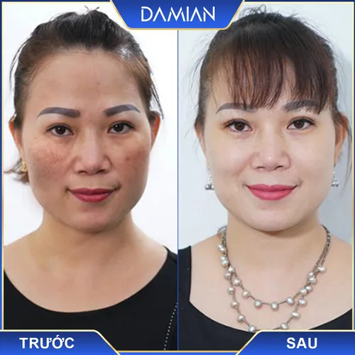 Viên Uống Trắng Da Damian Chính Hãng