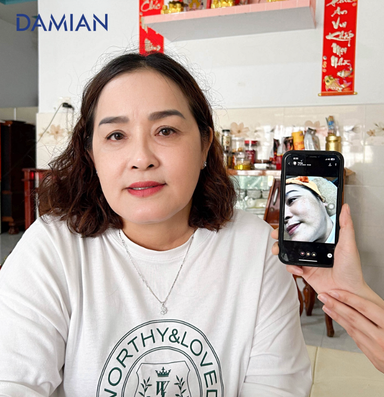 Viên uống trắng da damian có tốt không Viên uống trắng da damian có tốt không