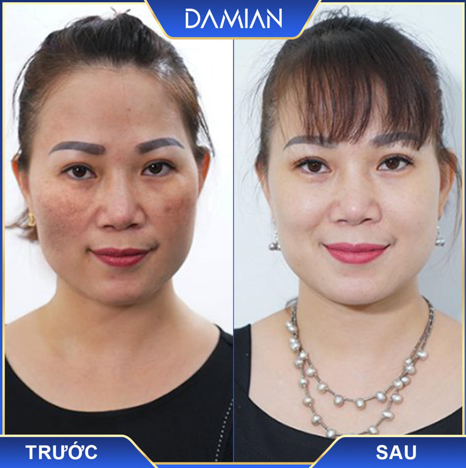 Viên uống trắng da damian mua ở đâu chính hãng Viên uống trắng da damian mua ở đâu chính hãng