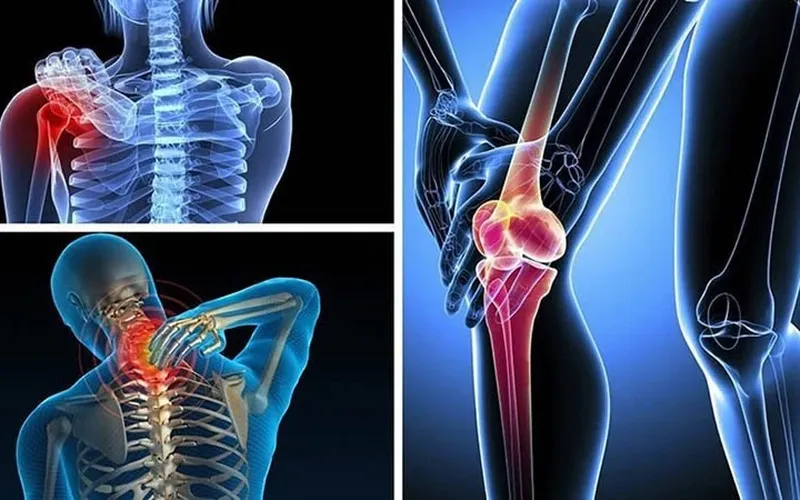 Trị Liệu Thoái Hóa Xương Khớp tại TP Vinh