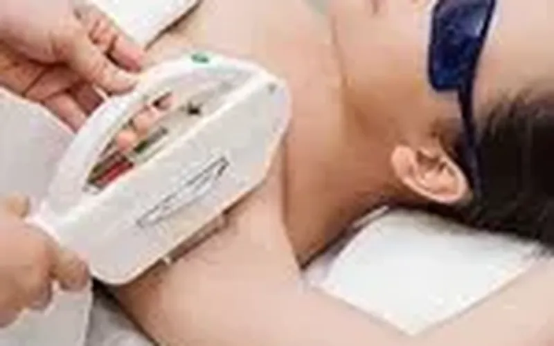 Triệt lông với DRNAVY tại Đắk Nông