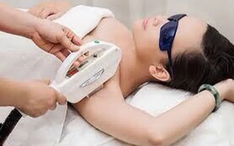 Triệt lông với DRNAVY tại Quảng Trị