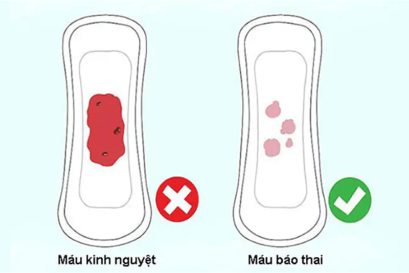 phan biet mau kinh nguyet va mau bao thai