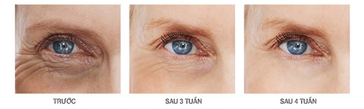 C eye serum advance hiệu quả ngay sau 4 tuần sử dụng