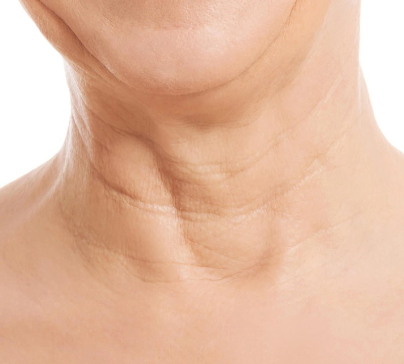 Vùng da cổ là nơi tố cáo tuổi tác của chị em phụ nữ.