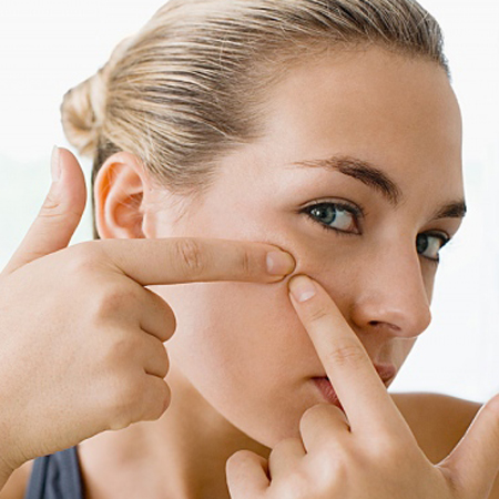 Mụn làm bạn thiếu tự tin khi giao tiếp