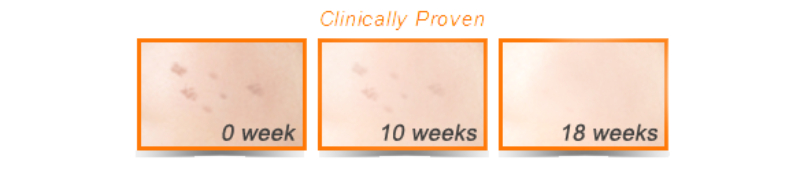 Hiệu quả sử dụng serum trị nám Sakura Transforming