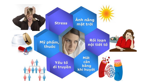 Các nguyên nhân gây nên nám da