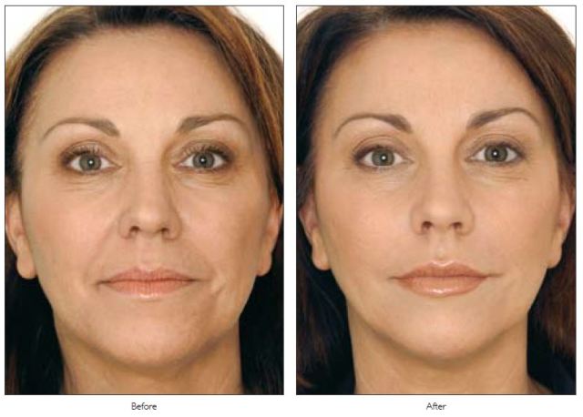 Trẻ lại từ 5 đến 10 tuổi