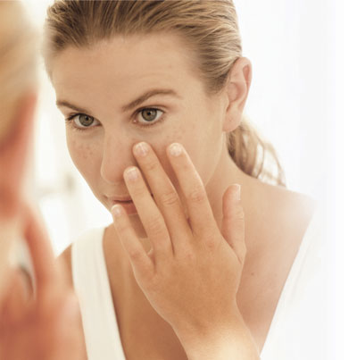 Nám da khiến khuôn mặt bản trở nên kém sắc