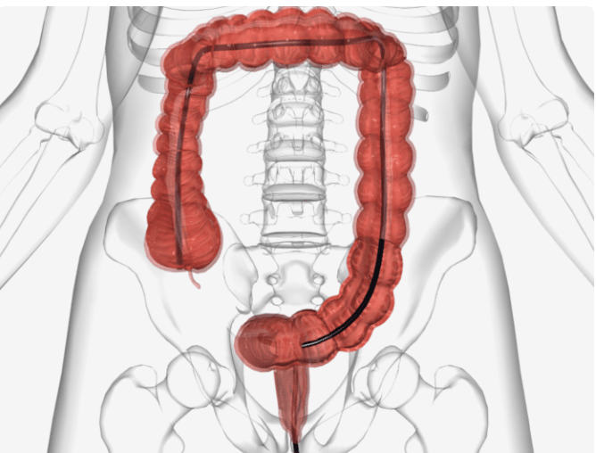 Quy trình nội soi
