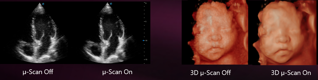 máy siêu âm màu 5d máy siêu âm màu 5d