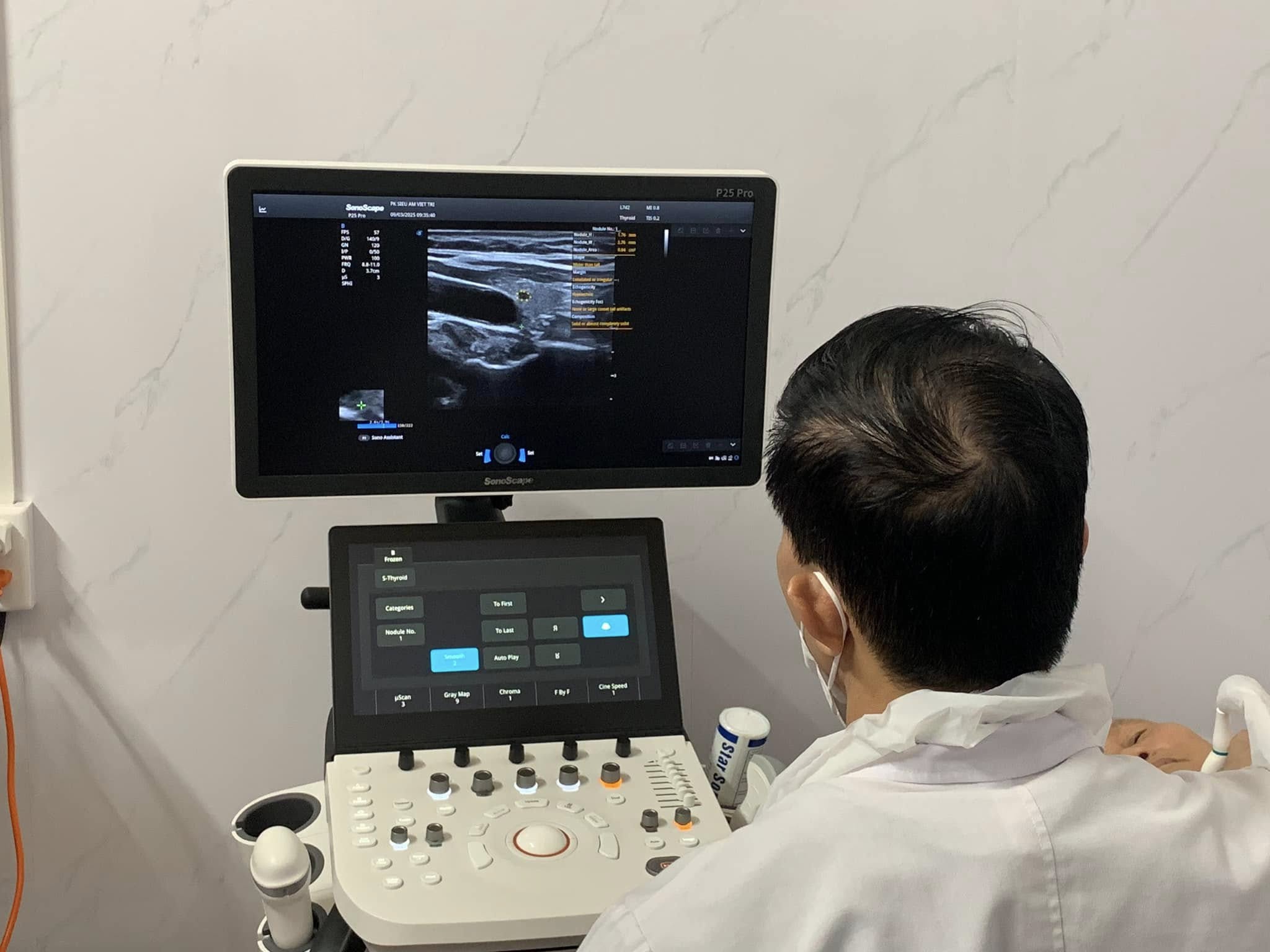 siêu âm sonoscape