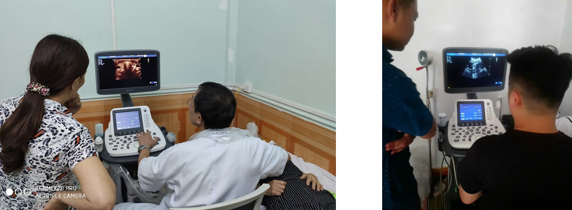 Hình ảnh SonoScape S22