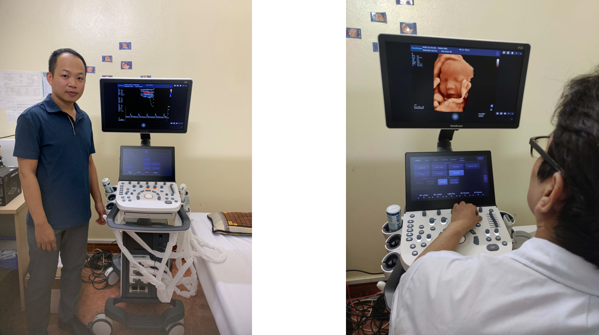 máy siêu âm 5D SonoScape P25 máy siêu âm 5D SonoScape P25
