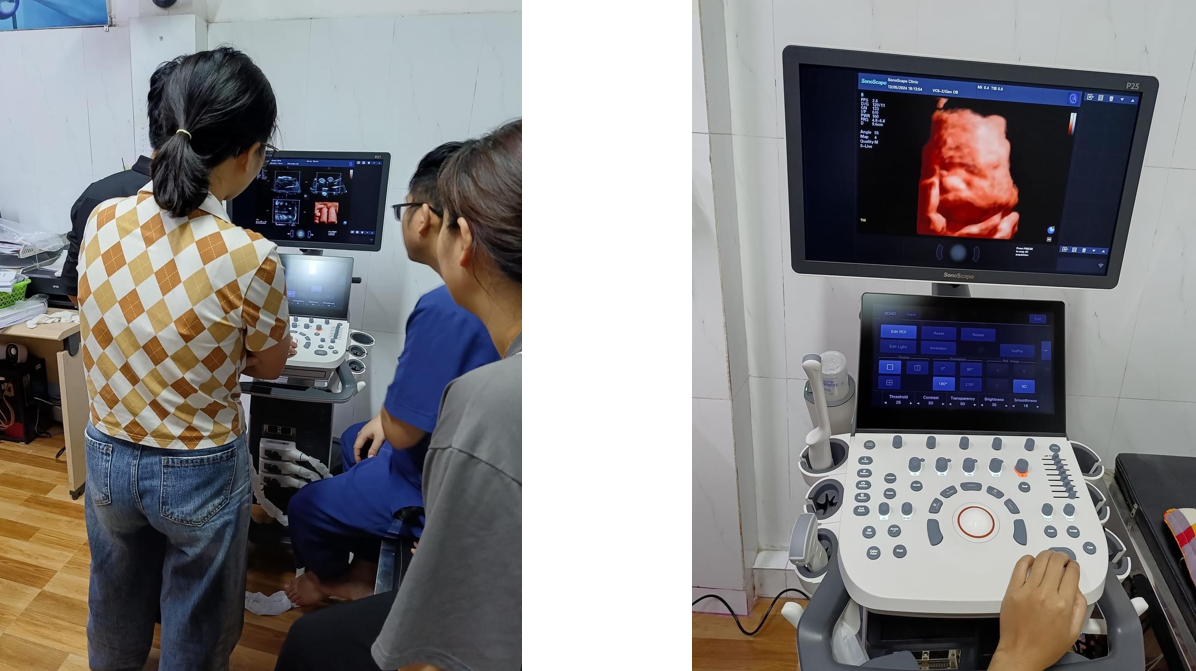máy siêu âm 5D 6D SonoScape P25 máy siêu âm 5D 6D SonoScape P25