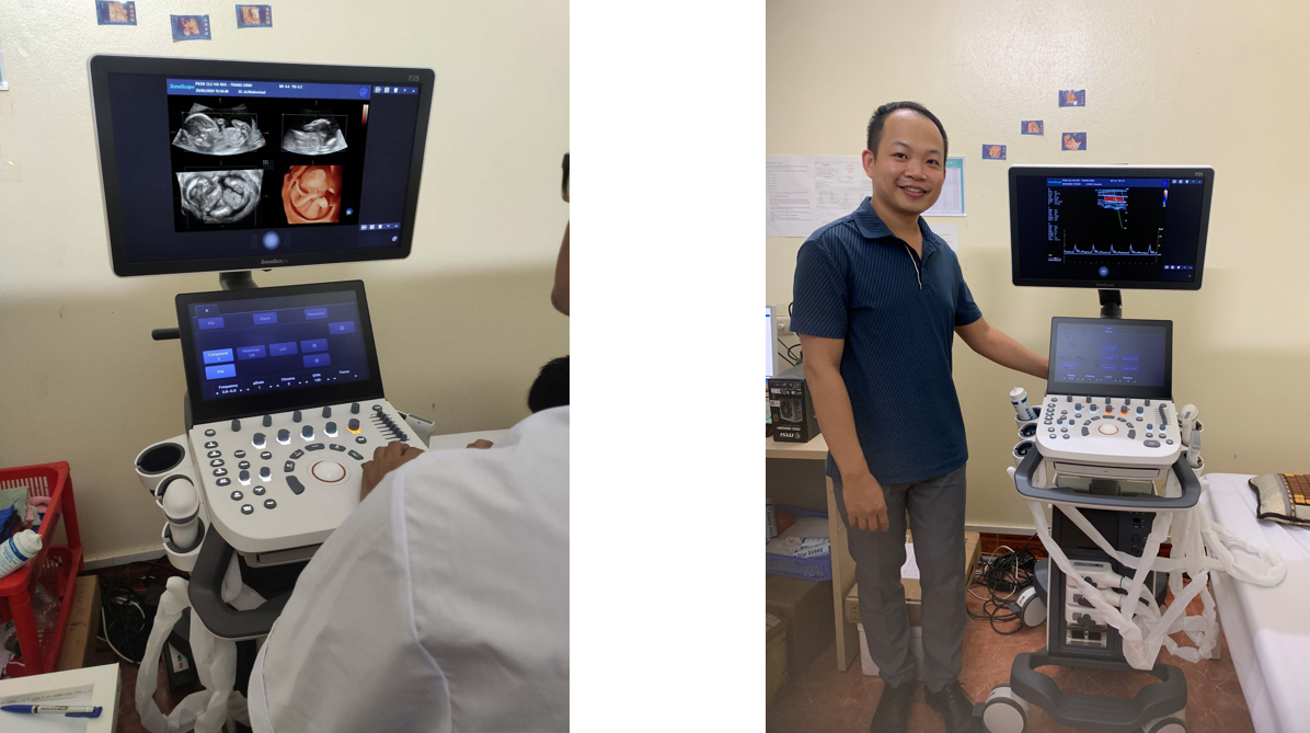 Hình ảnh 5D máy siêu âm SonoScape P25