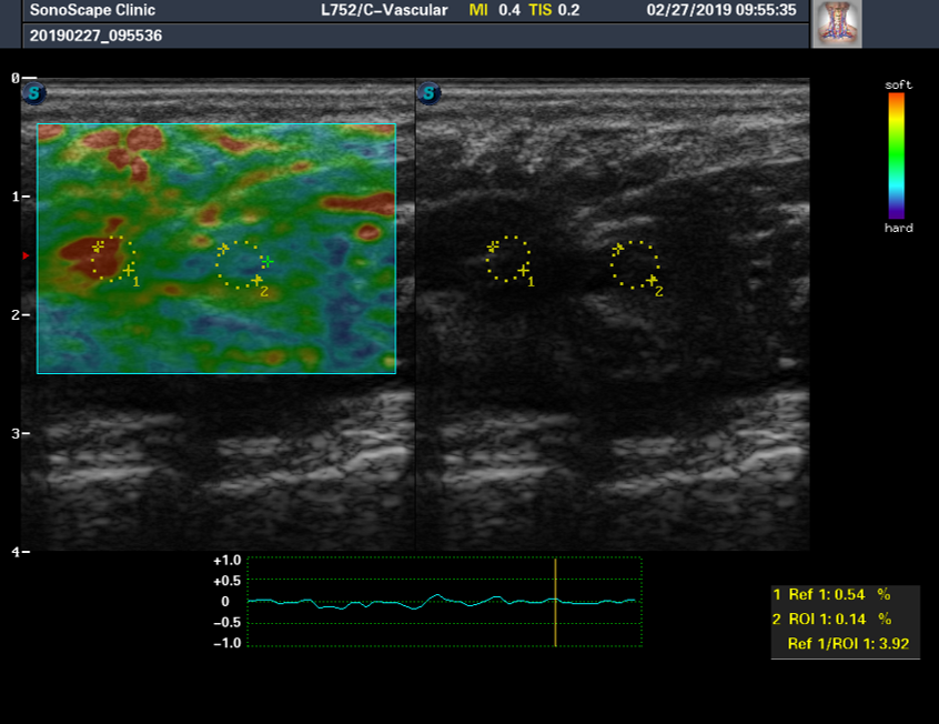 đàn hồi mô đàn hồi mô