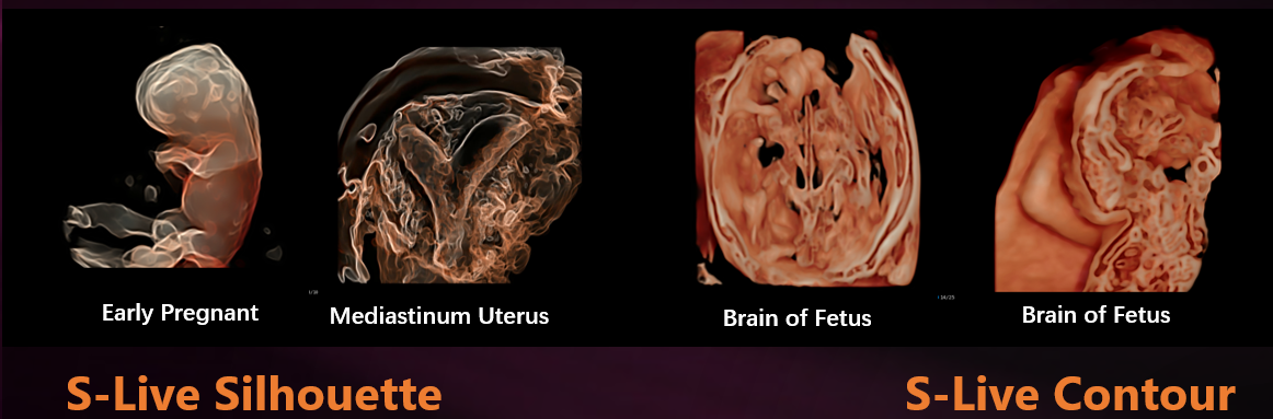 hình ảnh 5d thai hình ảnh 5d thai