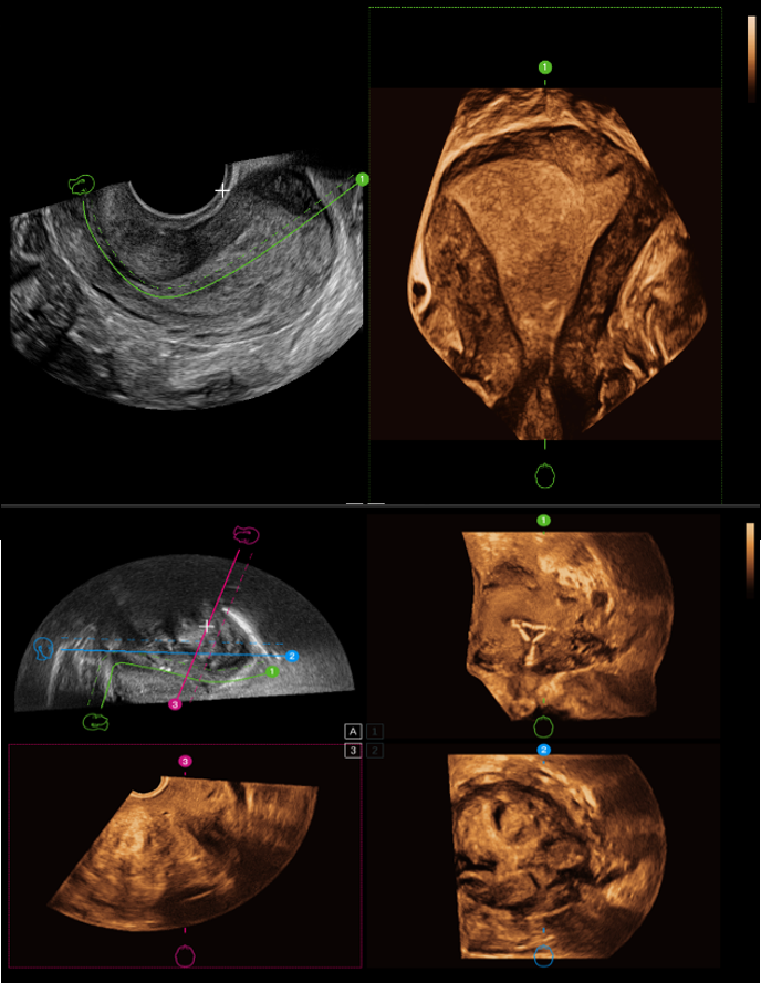Hình ảnh SonoScape Hình ảnh SonoScape
