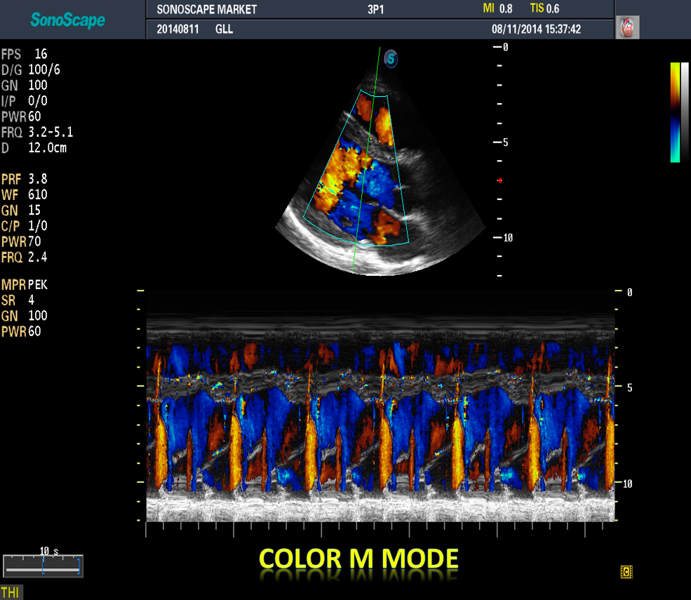máy siêu âm 4d M22 máy siêu âm 4d M22