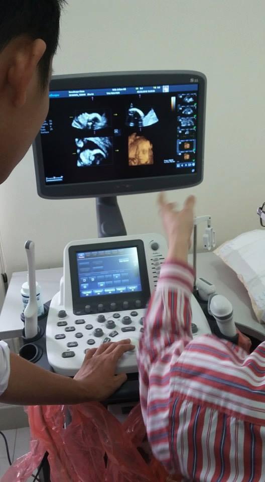 máy siêu âm 5D SonoScape M22 máy siêu âm 5D SonoScape M22