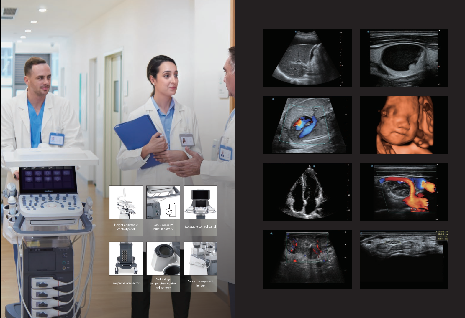 máy siêu âm sonoscape-p25 máy siêu âm sonoscape-p25