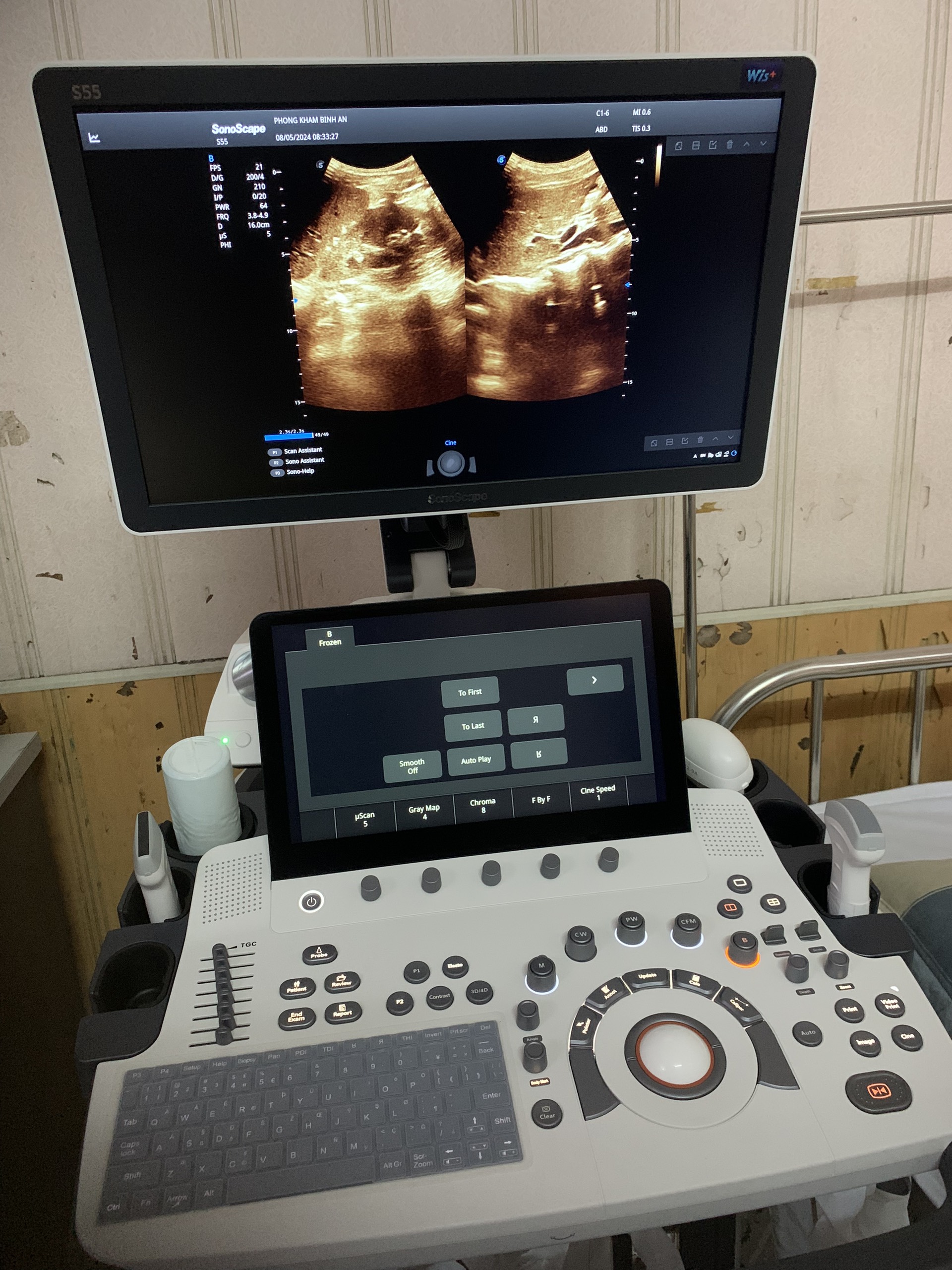 Máy siêu âm SonoScape S55 Máy siêu âm SonoScape S55