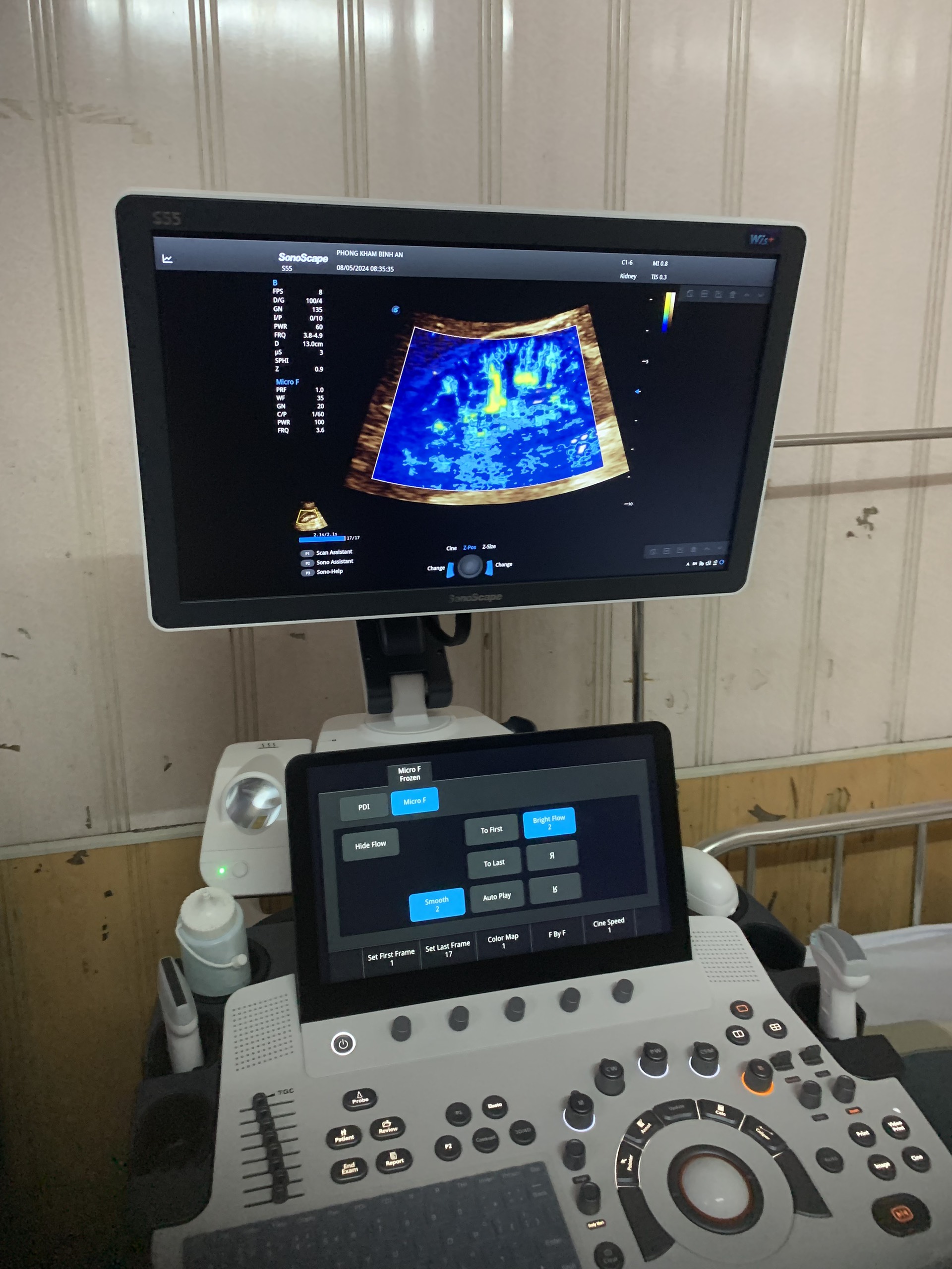 máy siêu âm SonoScape S55 máy siêu âm SonoScape S55